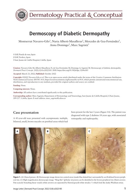 Pdf Dermoscopy Of Diabetic Dermopathy