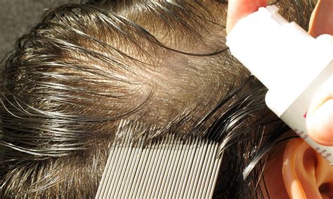 Parents in Rhyl demand action to combat head lice in ...