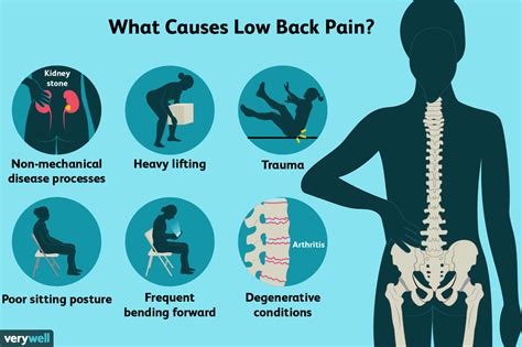 Back Pain Causes Treatment And When To See A Healthcare Provider