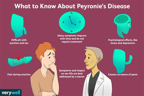 Symptome Der Peyronie Krankheit MedDe