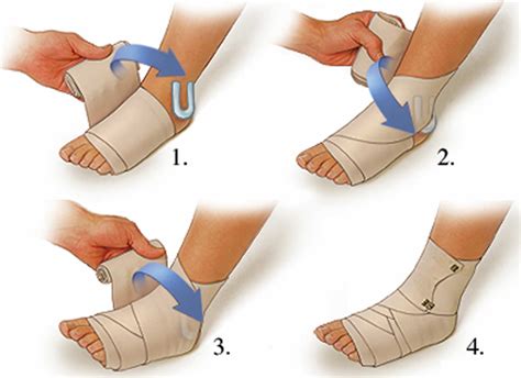 Sprained Ankle Symptoms Sprained Ankle Treatment And Recovery Time