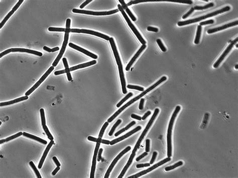 Bacillus Cereus Definição Causas Perigos Sintomas Diagnóstico