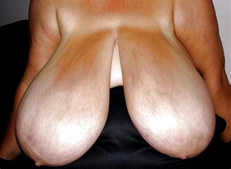 Huge Heavy Hanging Udders 11 Pics Xhamster