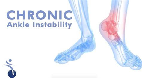 Jennifer spector, dpm, facfas | managing editor, podiatry today hmp communications, 70 e swedesford rd suite 100, malvern pa 19355. Chronic Ankle Stability - Podiatry HQ