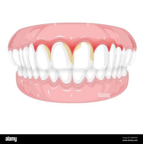 Tooth And Gums Icon Vector Vectors Hi Res Stock Photography And Images