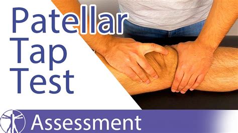 Patellar Tap Test Ballottement Test⎟knee Swelling Youtube