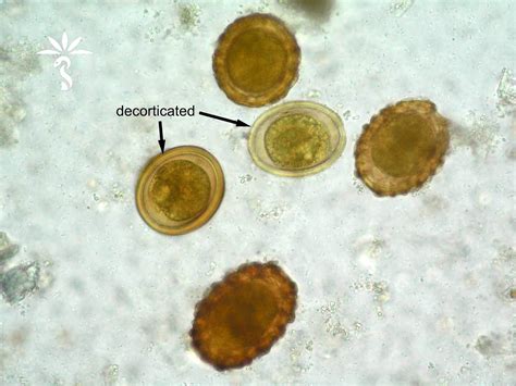 Ascaris Lumbricoides Egg