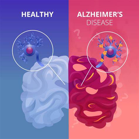 World Alzheimer's Day 2018 Can vitamin B12 supplementation further develop memory in Alzheimer's illness

