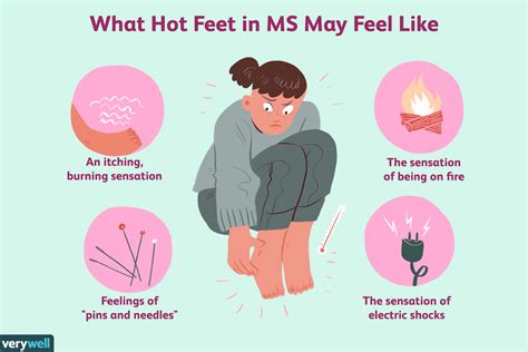 Hot Feet In Ms Symptoms Causes Diagnosis And Treatment