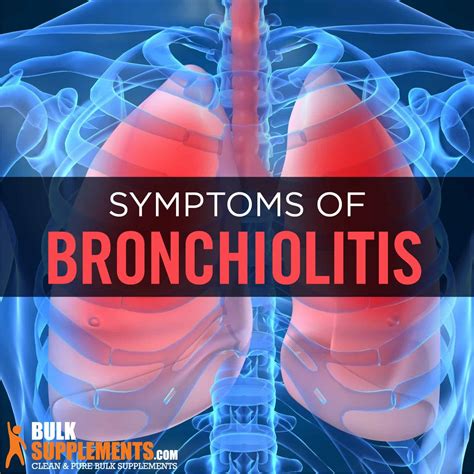 Bronchiolitis Symptoms Causes And Treatment By James Denlinger