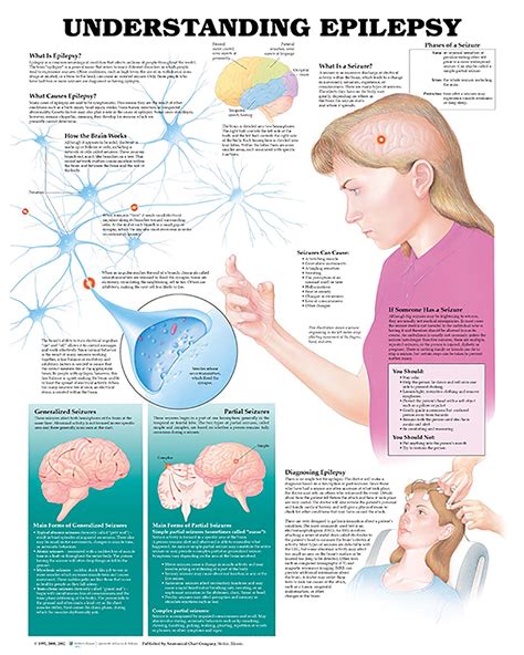 Understanding Epilepsy Anatomical Chart Soft Laminate Australian