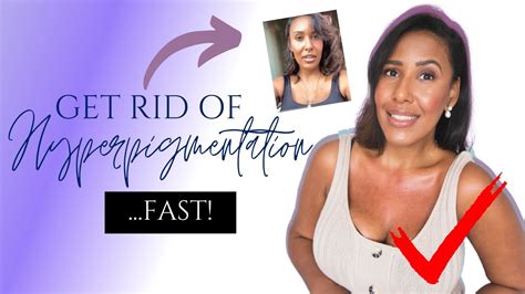 Get Rid Of Hyperpigmentation Scars Dark Spots And Boil Scars On Your