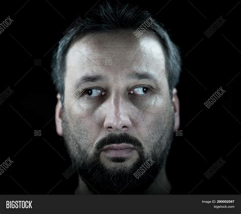 Crossed Eyes Opposite Image And Photo Free Trial Bigstock