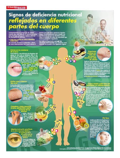 Infografía Deficiencia Nutricional El Guardián De La Salud