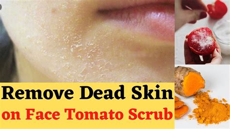 How To Remove Dead Skin From Face At Home How To Get Rid Of Dead Skin Cells On Body Youtube