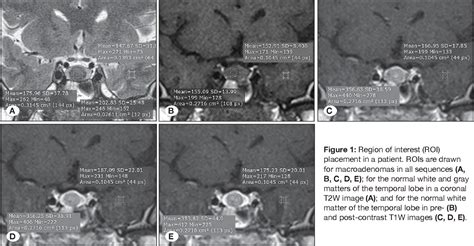 figure 1 from added value of dynamic contrast enhanced magnetic resonance imaging in predicting