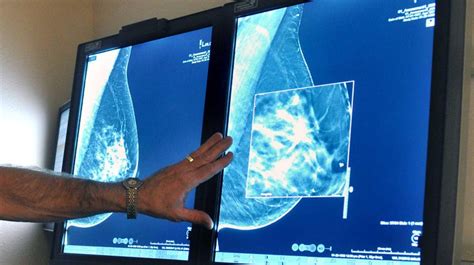American Cancer Society Changes Mammogram Guidelines Newsday
