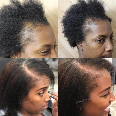 While hair loss is very common, losing your hair can still be a frustrating experience. 7 Tips To Regrow Your Edges - Strawberricurls | Natural ...