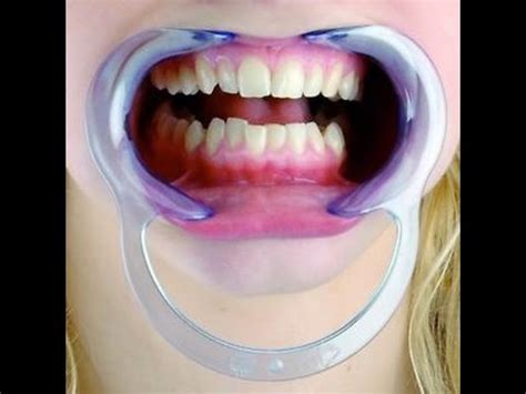 Since toothpaste is made mainly for teeth, the mouth guard may be also, dentist's opinion and advice is definitely the best way of knowing how to clean a mouth guard properly. Mouth Challenge / Mouthguard / Dental Mouth Opener ...