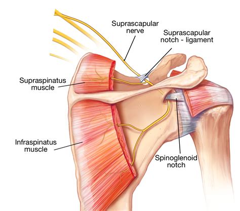 A Tiny Nerve In The Shoulder Can Create So Much Trouble All You Need