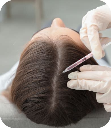 Female Hair Restoration Long Island Hair Transplant Center