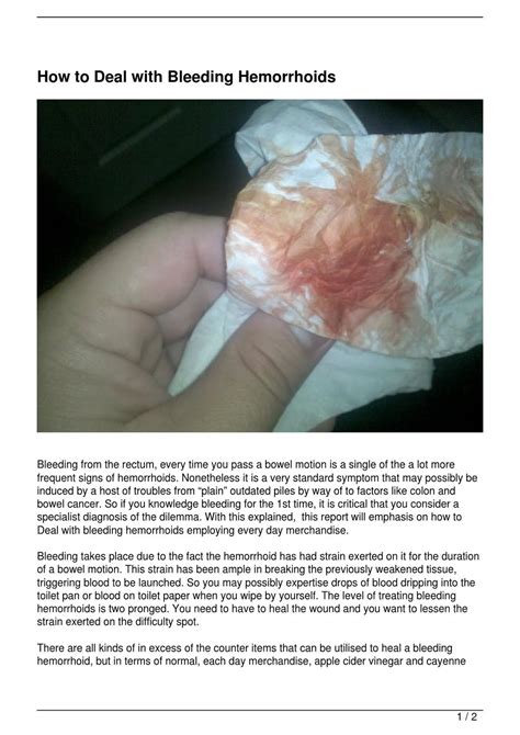 How To Deal With Bleeding Hemorrhoids By Felix Batista Issuu