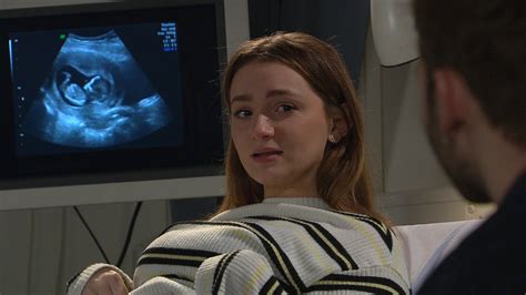 emmerdale spoilers gabby thomas and jamie tate attend their first scan trendradars