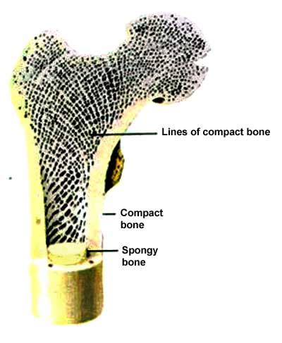 Femur in cross section produced while employed at radius digital science. Treatment of Avascular Necrosis of the Femoral Head with Chinese Herbs