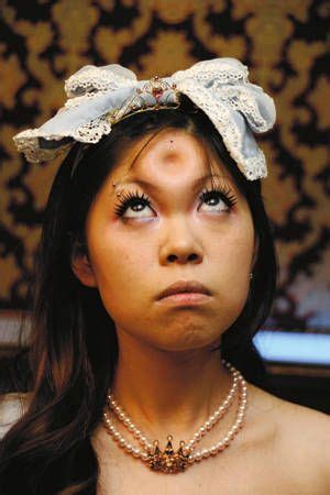Bagel Head Is A Type Of Body Modification Pioneered In Canada And