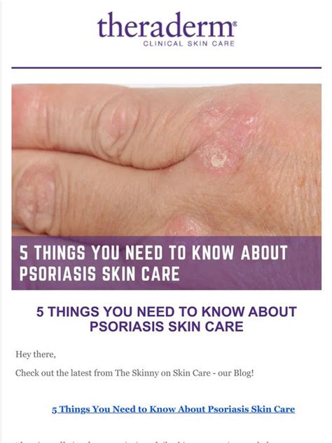 Therapon Skin Health 5 Things You Need To Know About Psoriasis Skin
