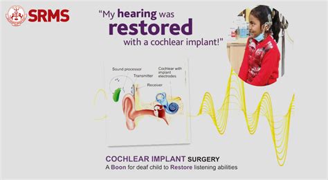 Cochlear Implant Surgery At Srms Ims Srms Ims Bareilly