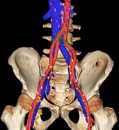 Retroperitoneal Lymph Nodes Anatomy