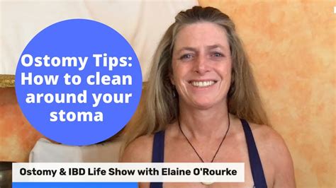 Ostomy Tips How To Clean Around Your Stoma Youtube