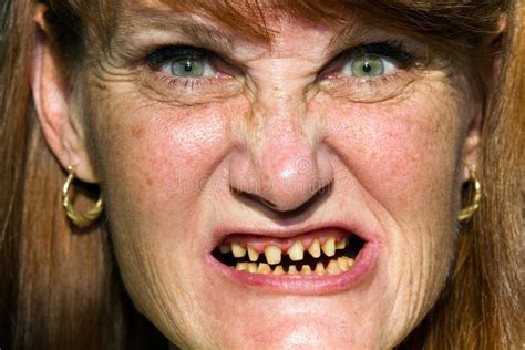 Scary Face Bad Teeth Stock Photo Image Of Dentist Halloween 26641590