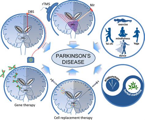 Complementary And Alternative Therapies Of Parkinson ‘s Disease
