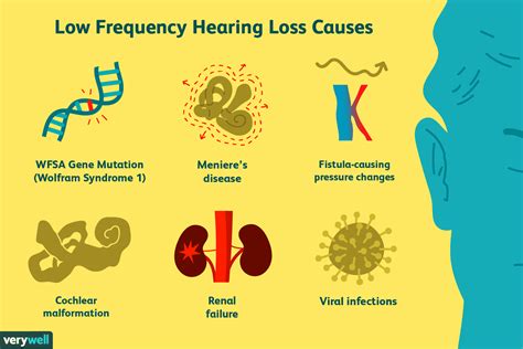 Can A Virus Cause Deafness Icphs