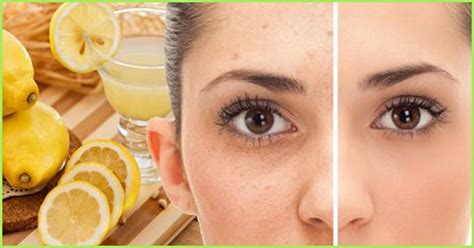 How to get clear skin, remove acne, and dark circles. Remove Freckles & Brown Spots with this Amazing DIY All ...