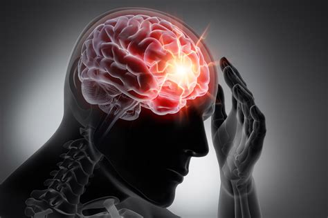 Traumatic Brain Injury —more Common Than You Think Advantage