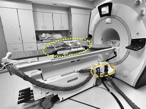 Magnetic Resonance Imagingguided Focused Ultrasound Ablation Of Lumbar