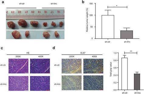 Knockdown Of LINC00152 Gene Suppressed Tumor Growth In Vivo A A