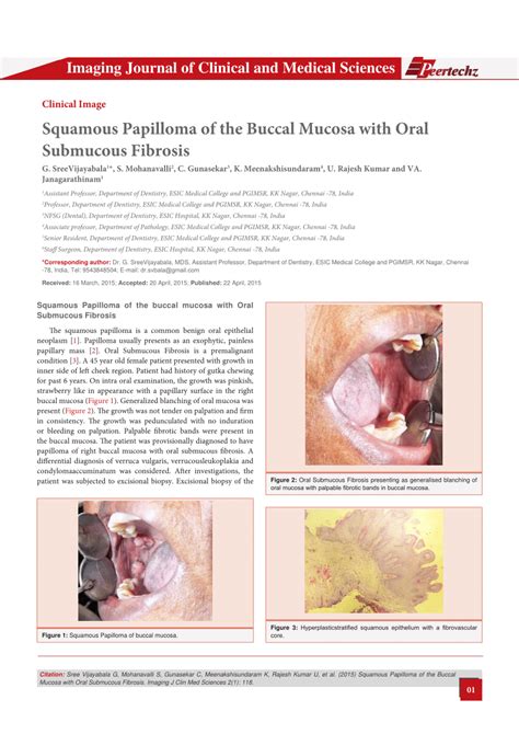 Pdf Squamous Papilloma Of The Buccal Mucosa With Oral Submucous Fibrosis