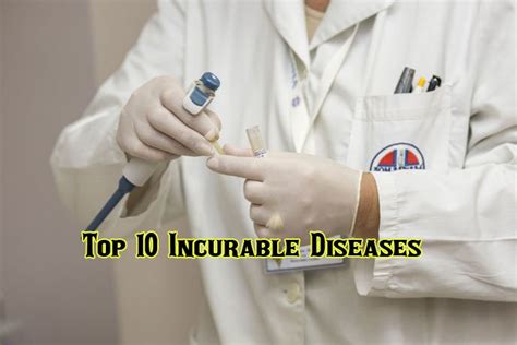Top 10 Incurable Diseases In The World You Should Know And Aware Now