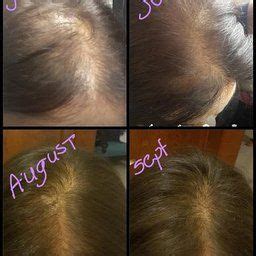 Viviscal hair growth program website:viviscal hair supplements price: Amazon.com: Customer Reviews: Viviscal Extra Strength Hair ...