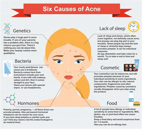 10 Skin Care Hacks To Prevent Acne The Naked Chemist