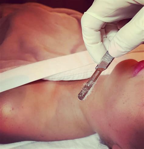 As you know that good blood. Dermaplaning: A Facial Worth Every Penny - Uplifted Beauty