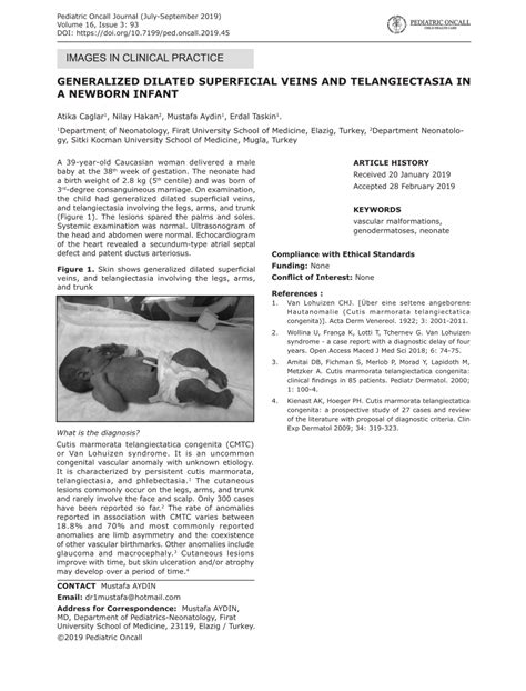 Pdf Generalized Dilated Superficial Veins And Telangiectasia In A