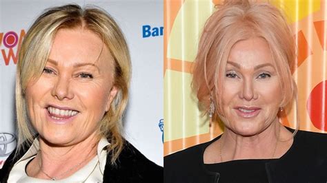 Deborra Lee Furness Plastic Surgery She Looked Young As Ever In Met