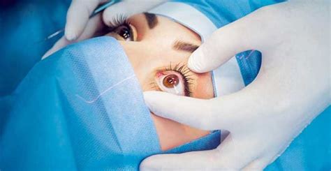 The Different Types Of Corrective Eye Surgery Eye Surgery Lasik Eye