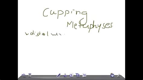 Quick Radiology Cupping Of Metaphysis Youtube