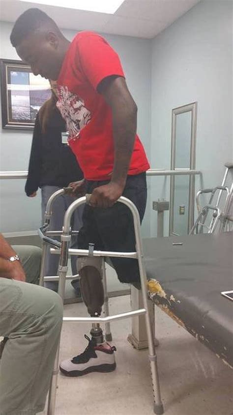 A Year After Losing His Legs This High School Senior Walked To Get His
